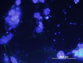 Obarvená jádra kmenových buněk pomocí fluorescenčního barviva DAPI