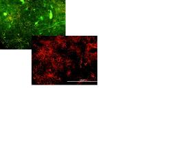 Ukázka zeleně a červeně obarvených astrocytů pomocí imunofluorescence