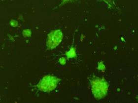 Neurodiferencovaná kmenová buňka transfekovaná zeleně svítícím proteinem